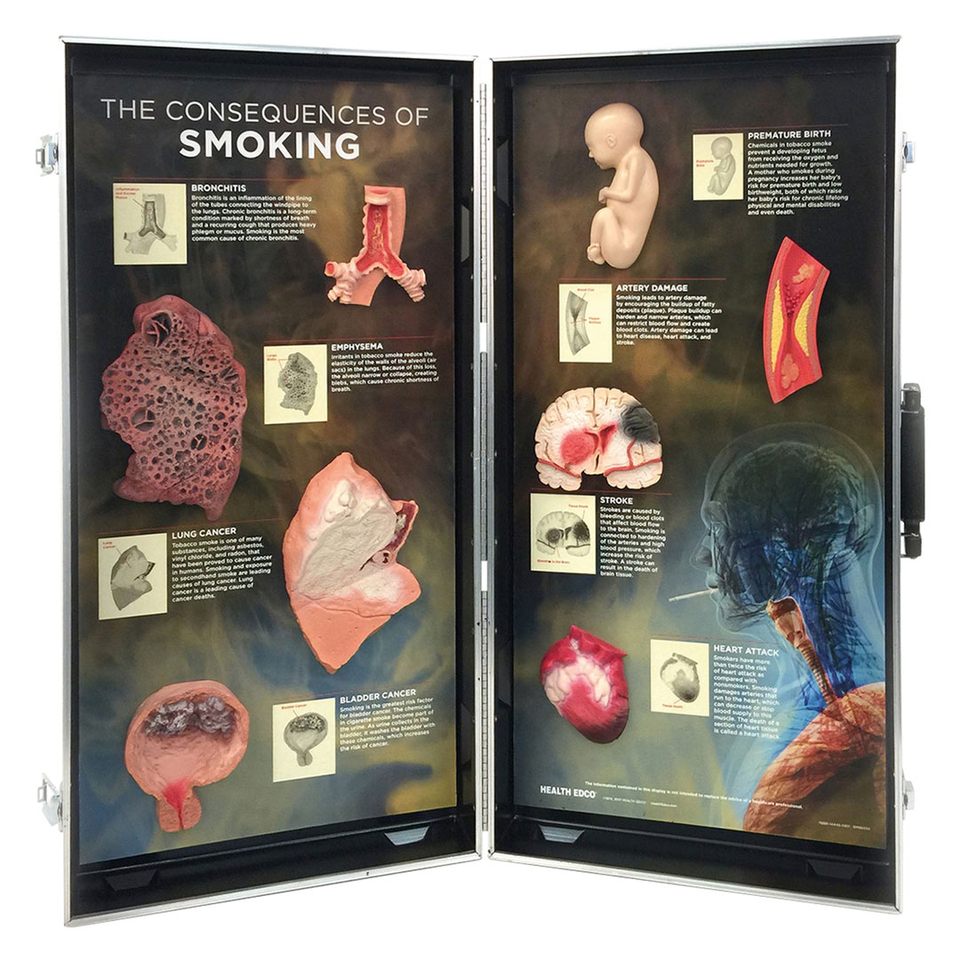 3B SCIENTIFIC Die Folgen des Rauchens - 3D-Schautafel geöffnet 71x67cm (W43047)