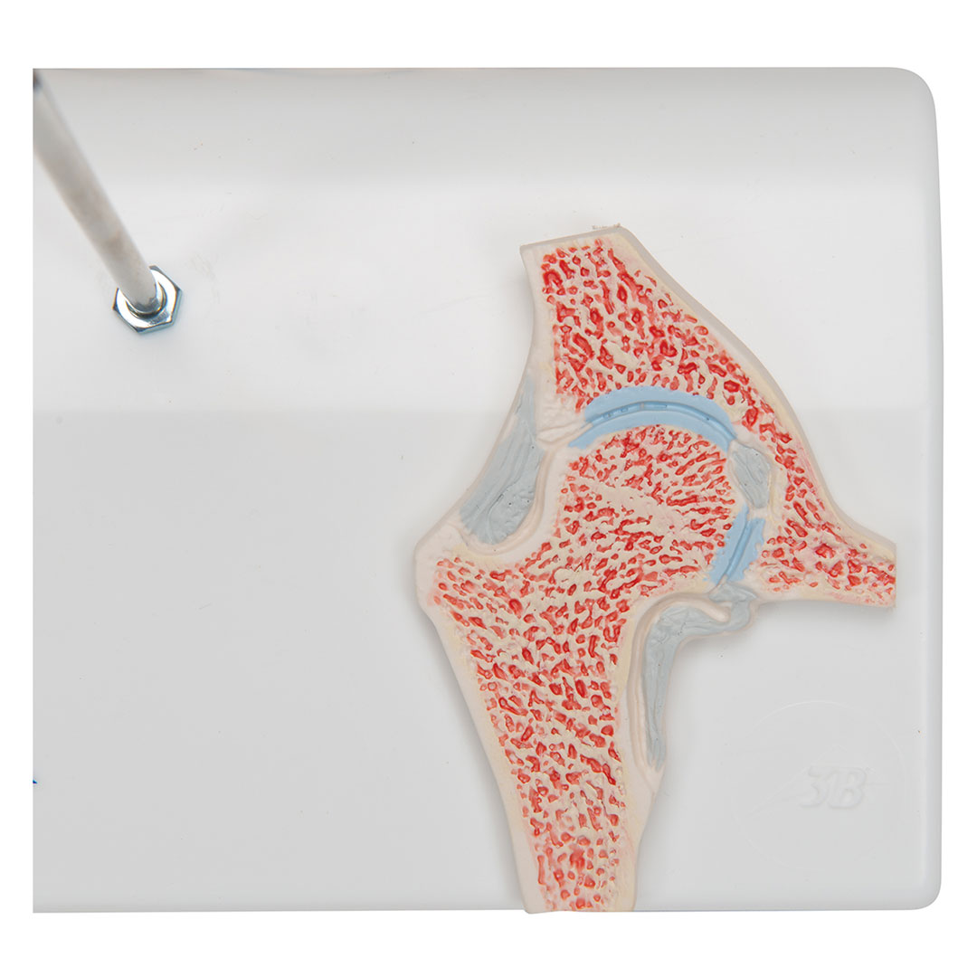 3B SCIENTIFIC Mini-Hüftgelenk m.Querschnitt (A84/1)