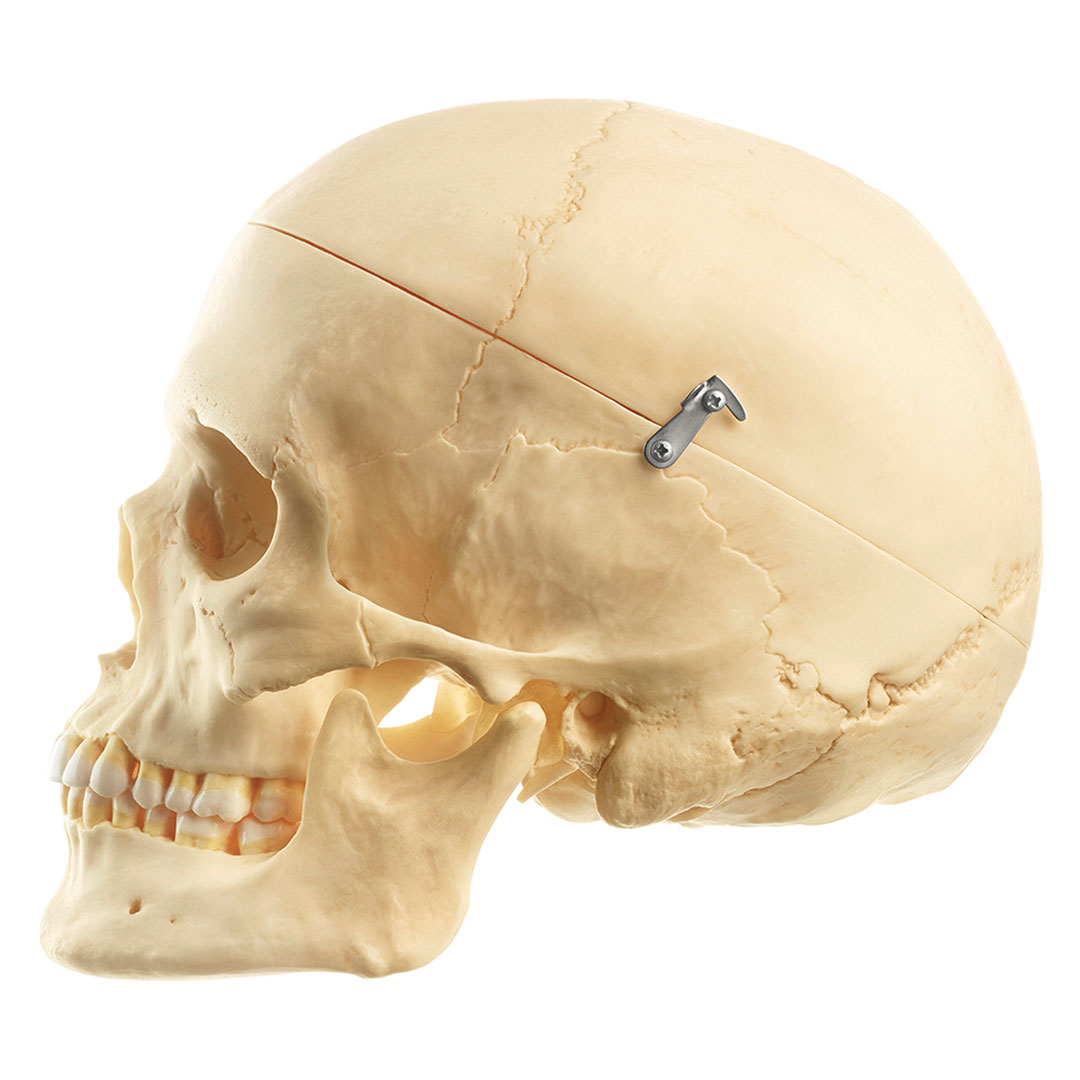 SOMSO® SCHÄDEL, weiblich