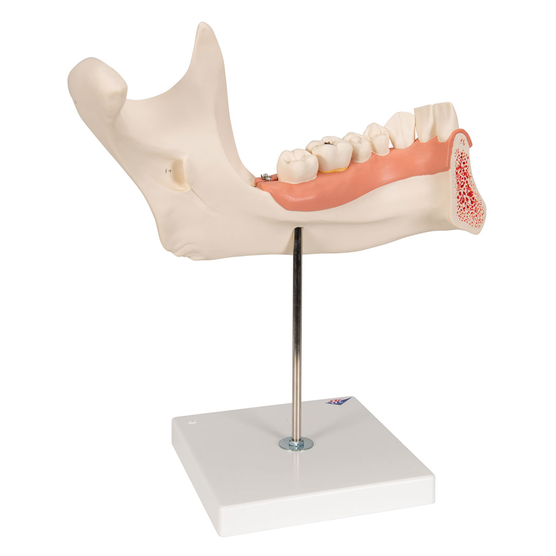 3B SCIENTIFIC Unterkiefer 6-tlg. (D25), 3-fach