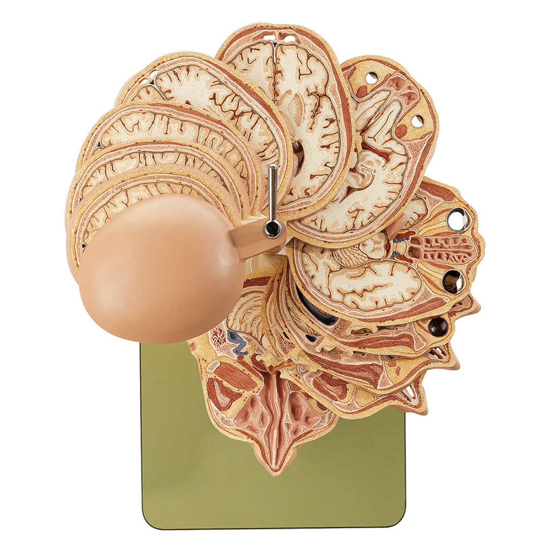 SOMSO® Kopf, Schnittmodell