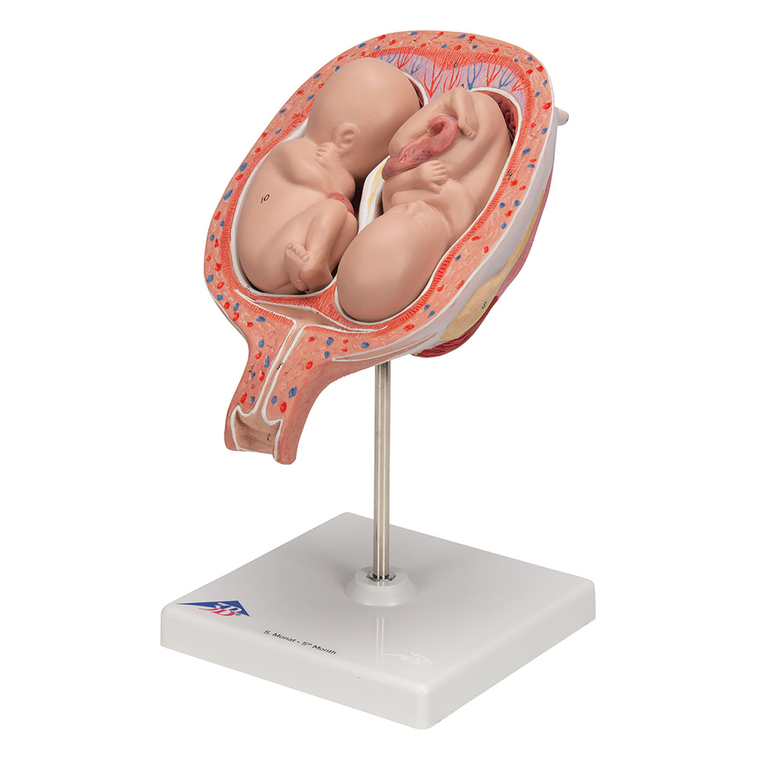 3B SCIENTIFIC Uterus mit Zwillingsfeten, 3-tlg (L10/7)