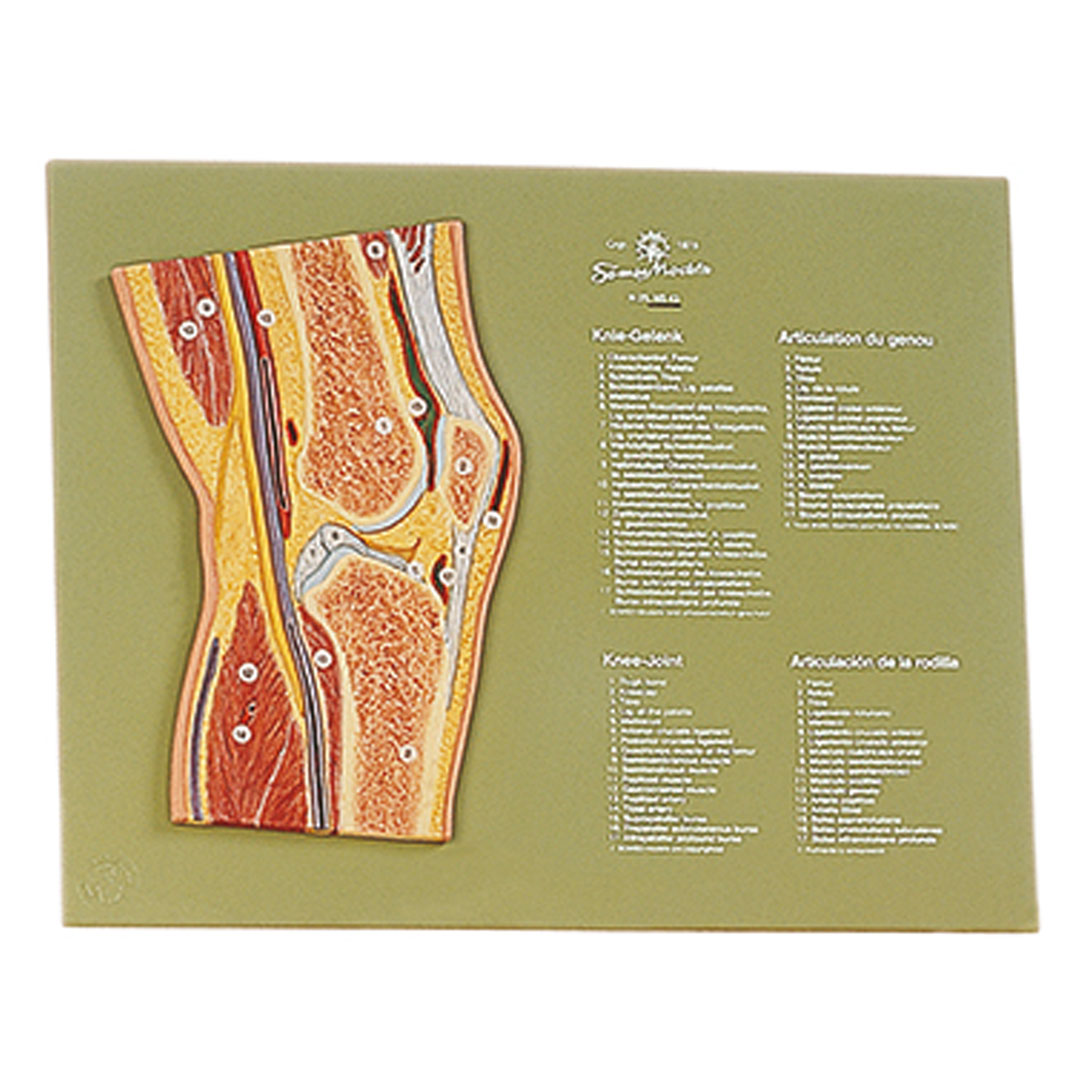 SOMSO® Gelenkschnitt Kniegelenk SOMSO® Gelenkschnitt Kniegelenk