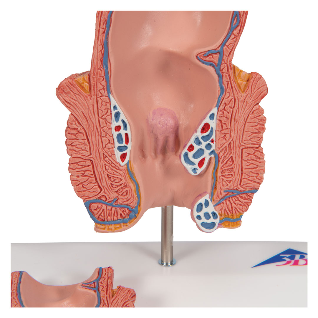 3B SCIENTIFIC Hämorrhoidenmodell (K27)