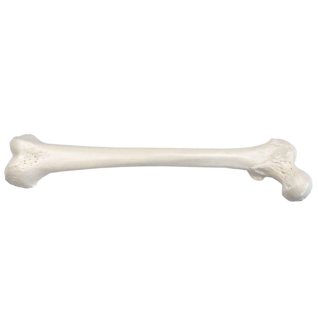SOMSO® Oberschenkelknochen (Femur)