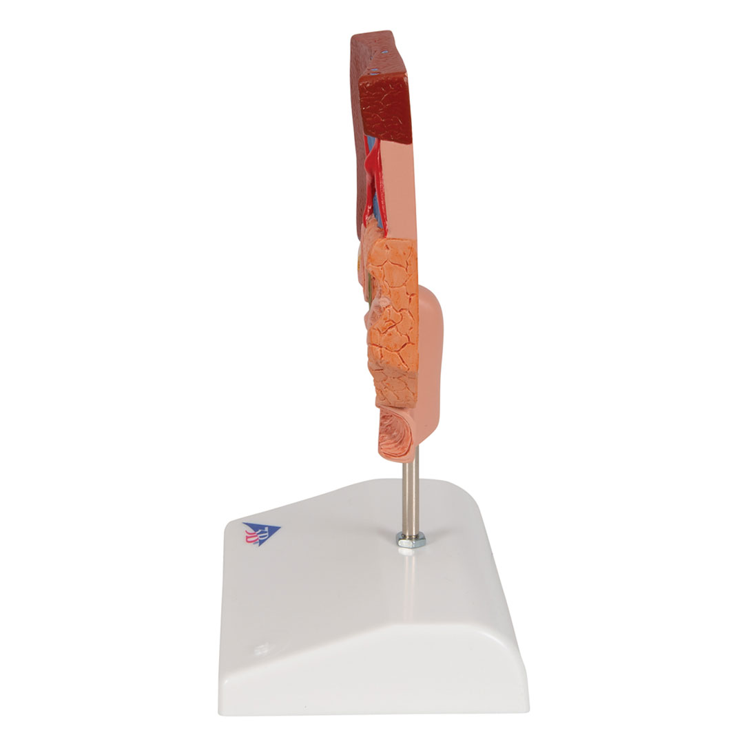 3B SCIENTIFIC Gallensteine, Modell (K26)