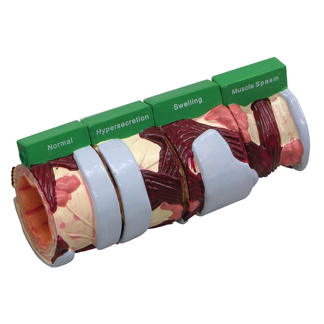 3B SCIENTIFIC Bronchusmodell 4-teilig, (W33362)