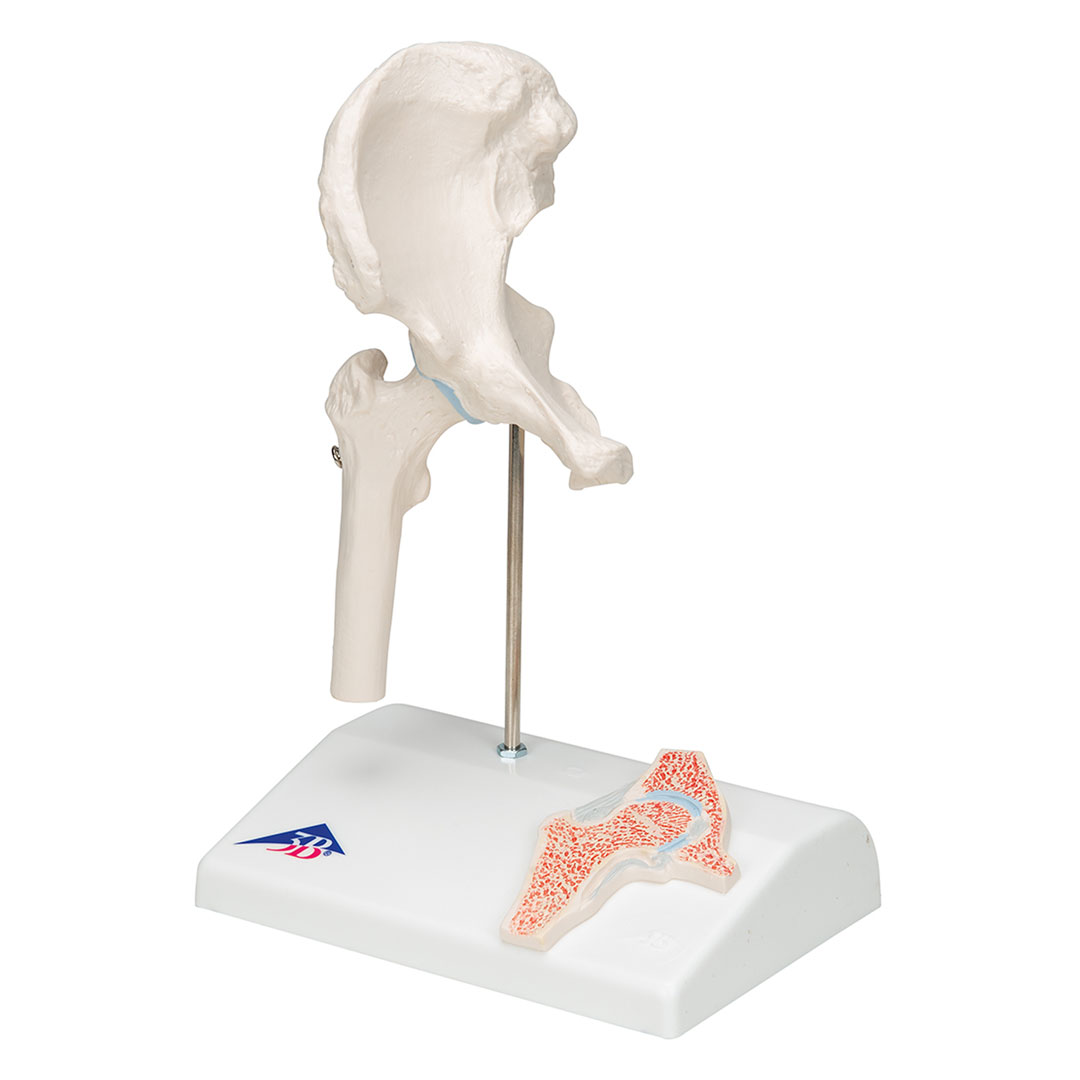 3B SCIENTIFIC Mini-Hüftgelenk m.Querschnitt (A84/1)