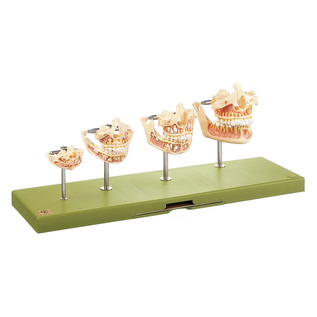 SOMSO® Gebissentwicklung*