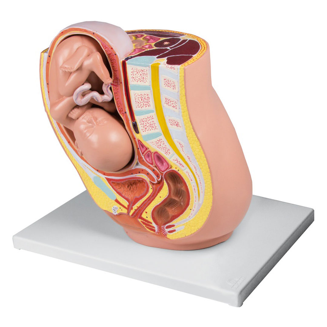 ERLER ZIMMER Schwangerschaftsbecken mit Fetus 32. Woche, 2-teilig