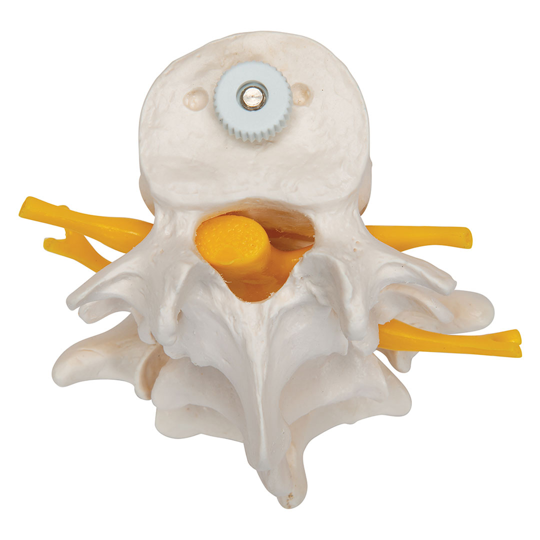 3B SCIENTIFIC 3 Lendenwirbel, elastisch mont. (A76/8)