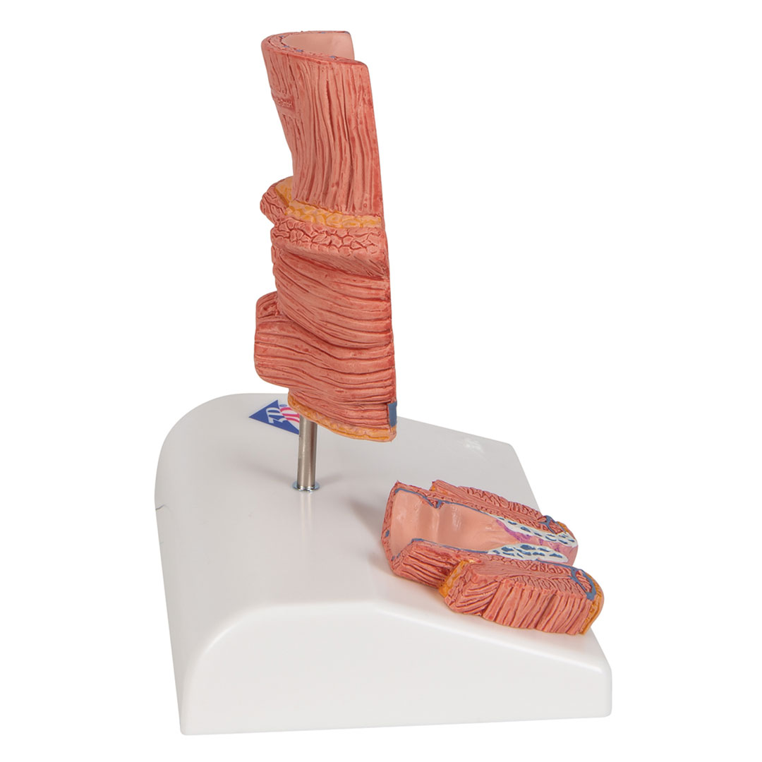 3B SCIENTIFIC Hämorrhoidenmodell (K27)