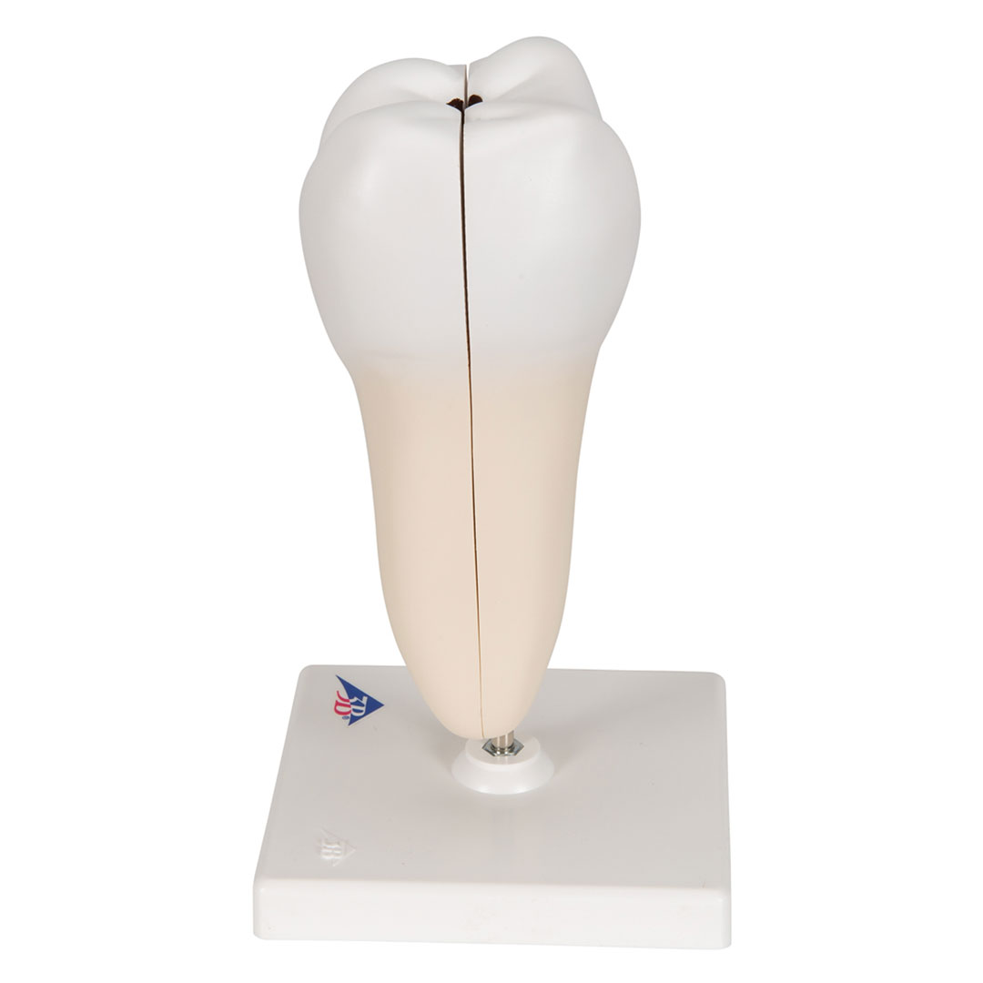 3B SCIENTIFIC Unterer 2-wurzl.Backenzahn m.Karies,2-t. (D10/4)