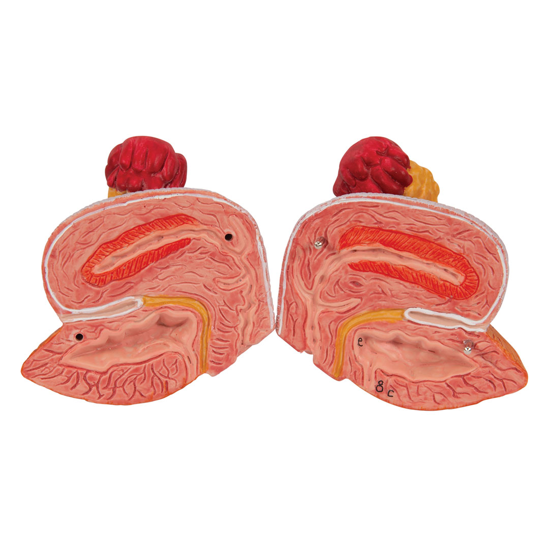 3B SCIENTIFIC Harnapparat, zweigeschl., 6-teilig (K32)