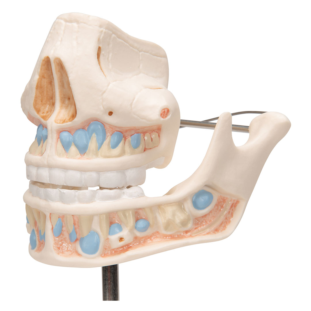 3B SCIENTIFIC Ober- und Unterkiefer, Kind (VE282)