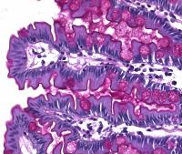 Blutausstrich Schnellfärbekit, 3x100ml