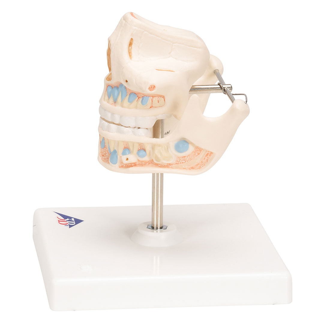 3B SCIENTIFIC Ober- und Unterkiefer, Kind (VE282)