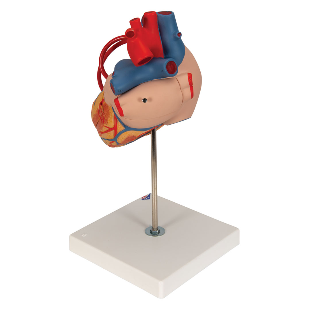 3B SCIENTIFIC Herzmodell m. Bypass, 4-tlg.2-fach v (G06)