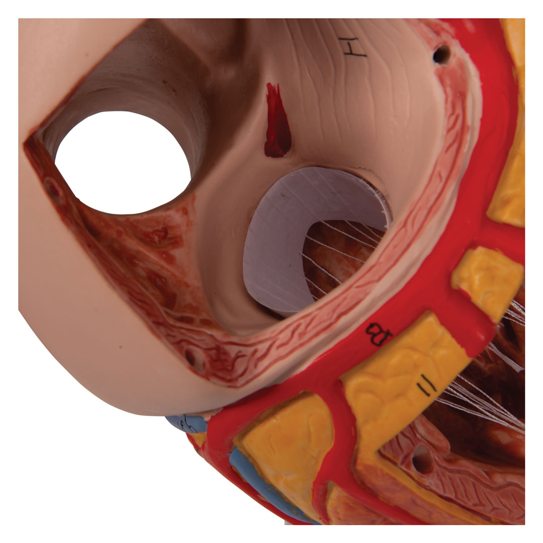 3B SCIENTIFIC Herz,  4-teilig, 2-fache Grösse (G12)