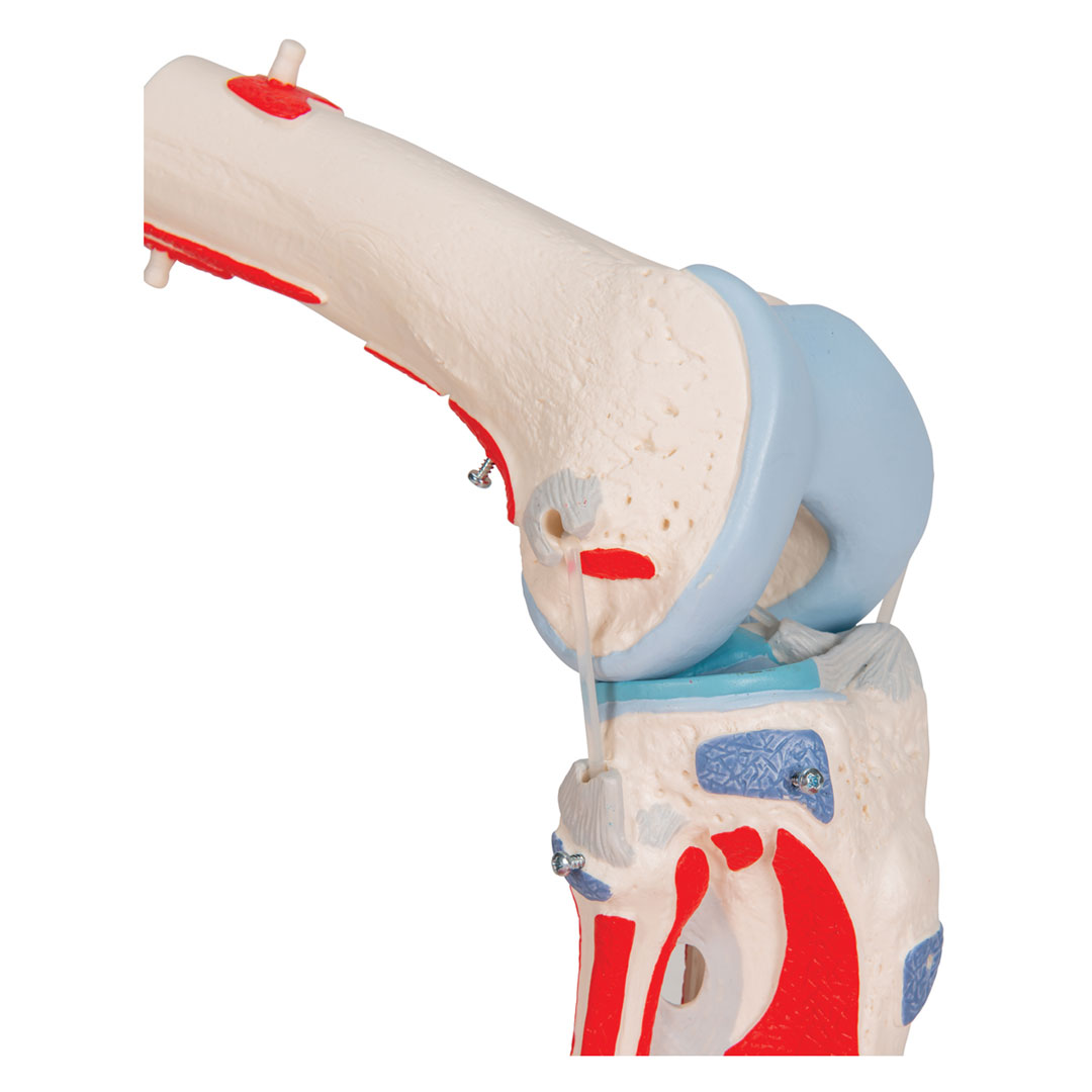 3B SCIENTIFIC Kniegelenk, 12-teilig, Grösse 33x17x17cm (A882)