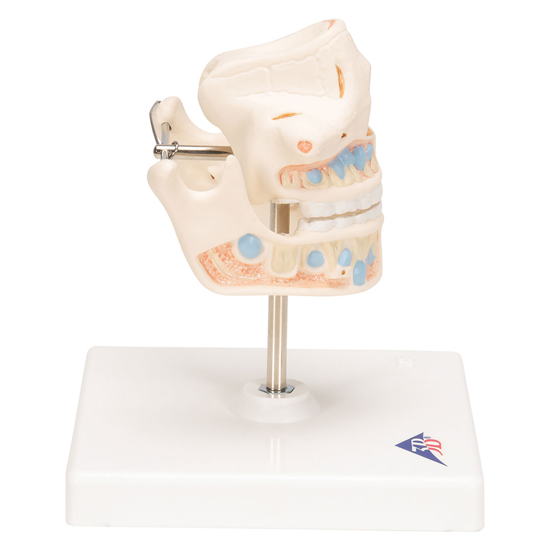 3B SCIENTIFIC Ober- und Unterkiefer, Kind (VE282)