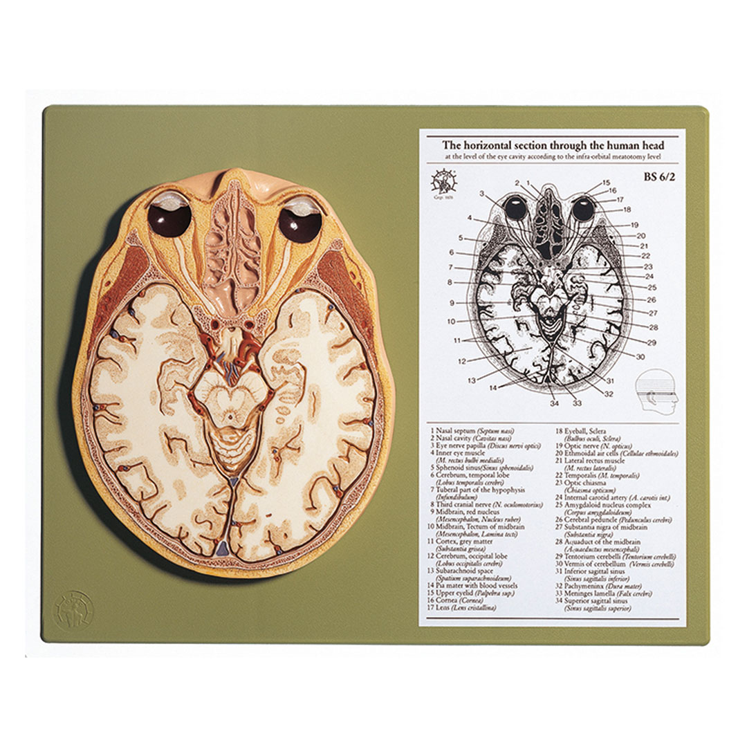 SOMSO® Kopf, Medianschnitt