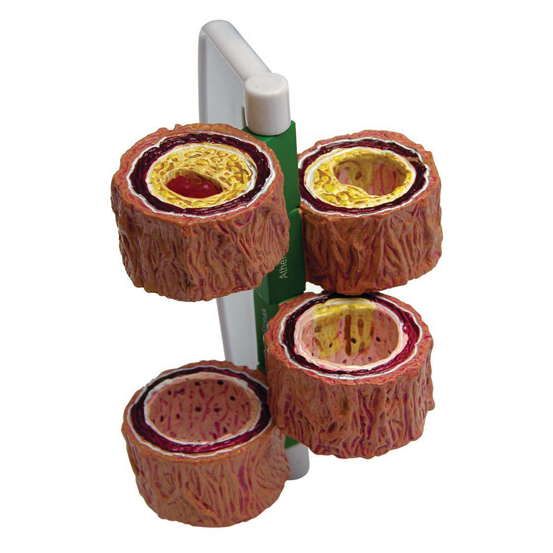 3B SCIENTIFIC Arterienabschnitte (4) (überdimensioniert) - mit Griff