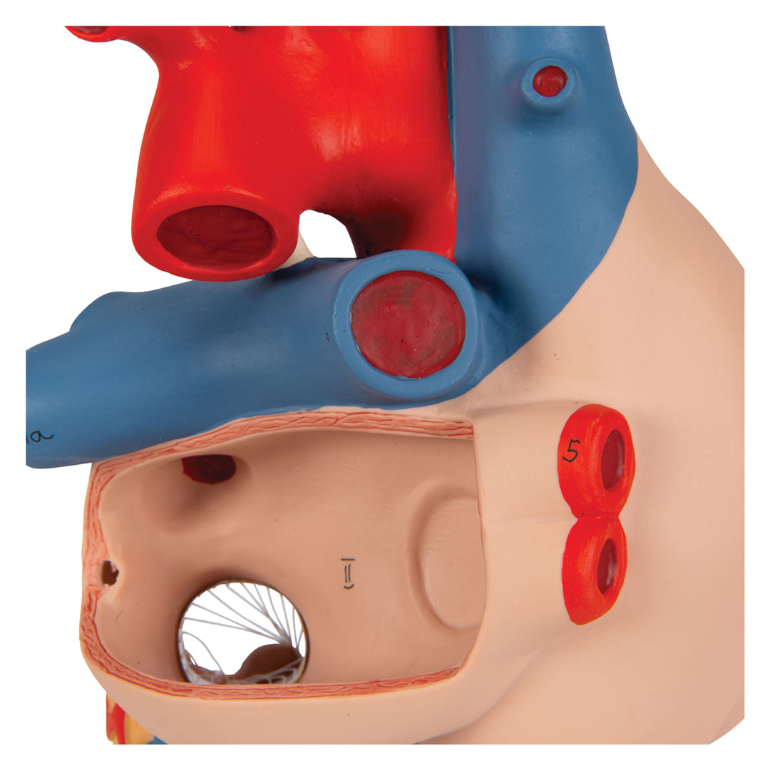 3B SCIENTIFIC Herzmodell m. Bypass, 4-tlg.2-fach v (G06)
