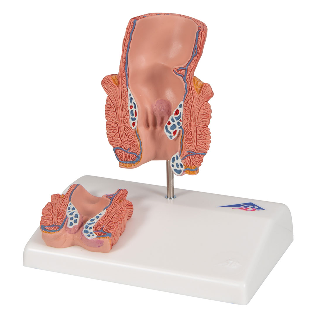 3B SCIENTIFIC Hämorrhoidenmodell (K27)