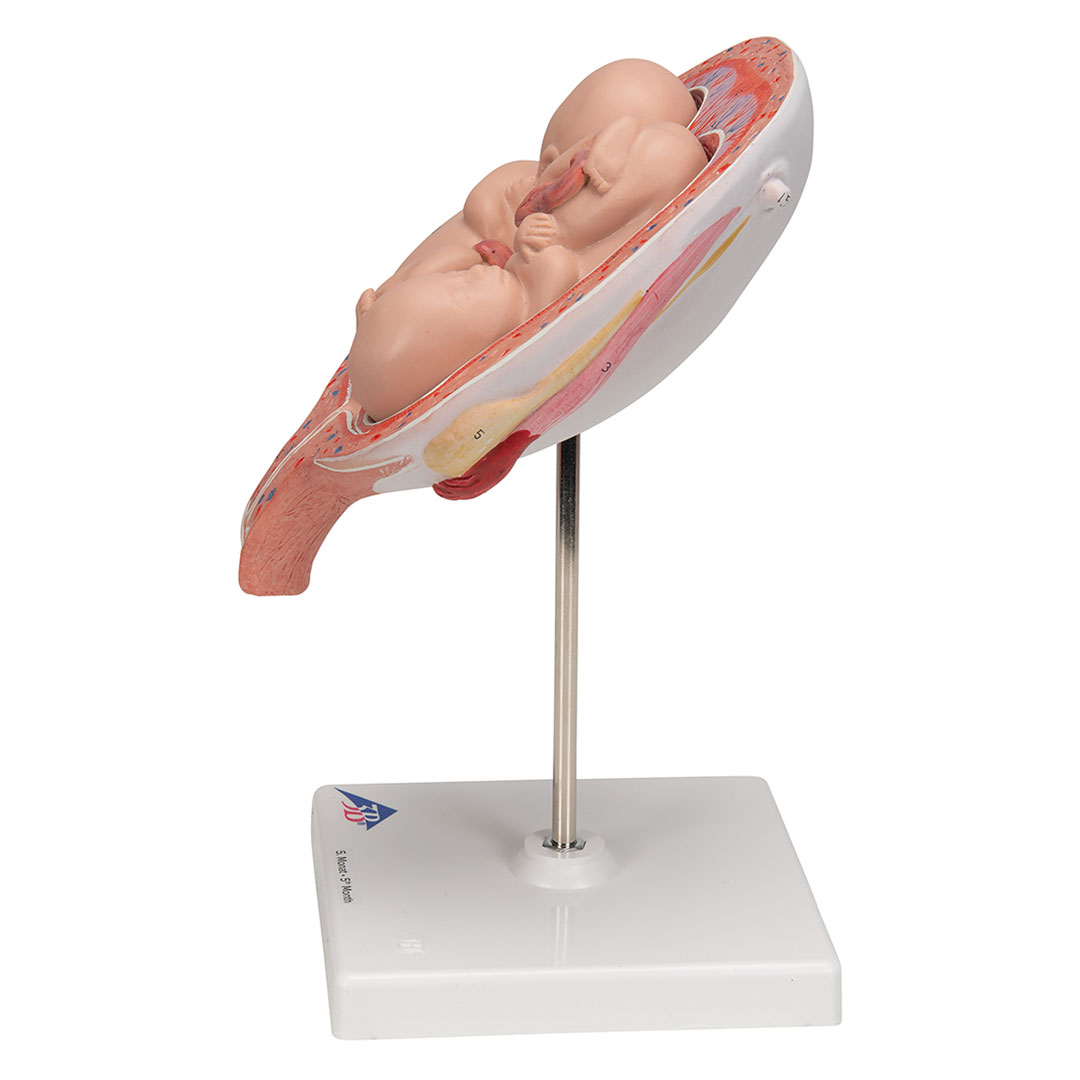 3B SCIENTIFIC Uterus mit Zwillingsfeten, 3-tlg (L10/7)