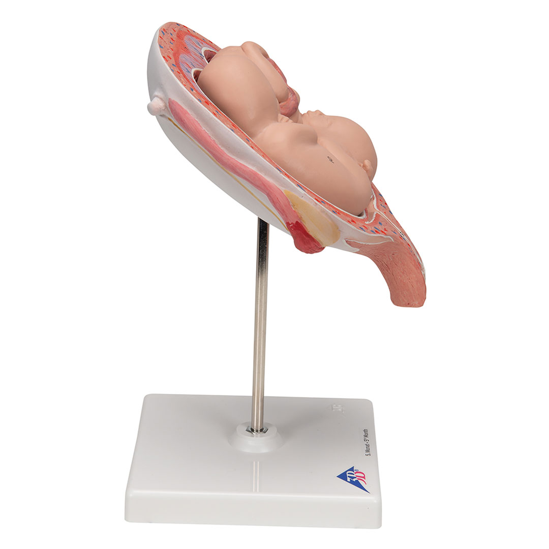 3B SCIENTIFIC Uterus mit Zwillingsfeten, 3-tlg (L10/7)