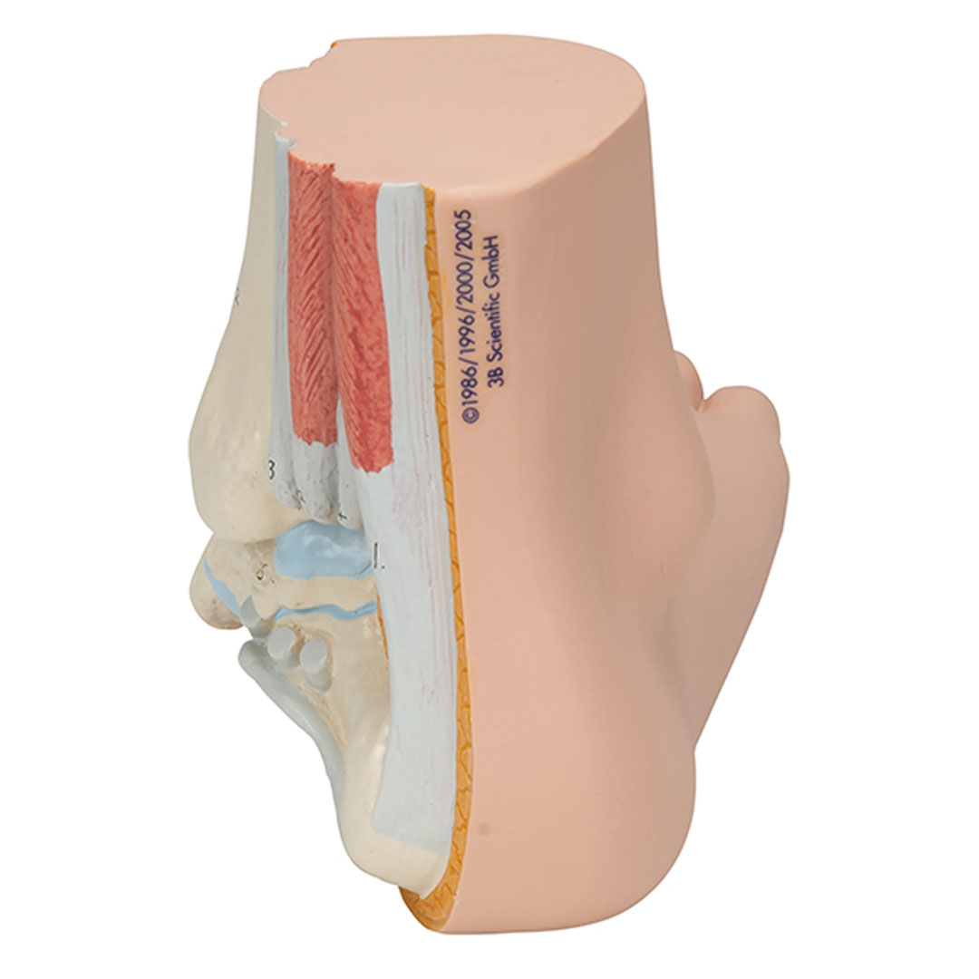 3B SCIENTIFIC Plattfuss, natürl. Grösse (M31)
