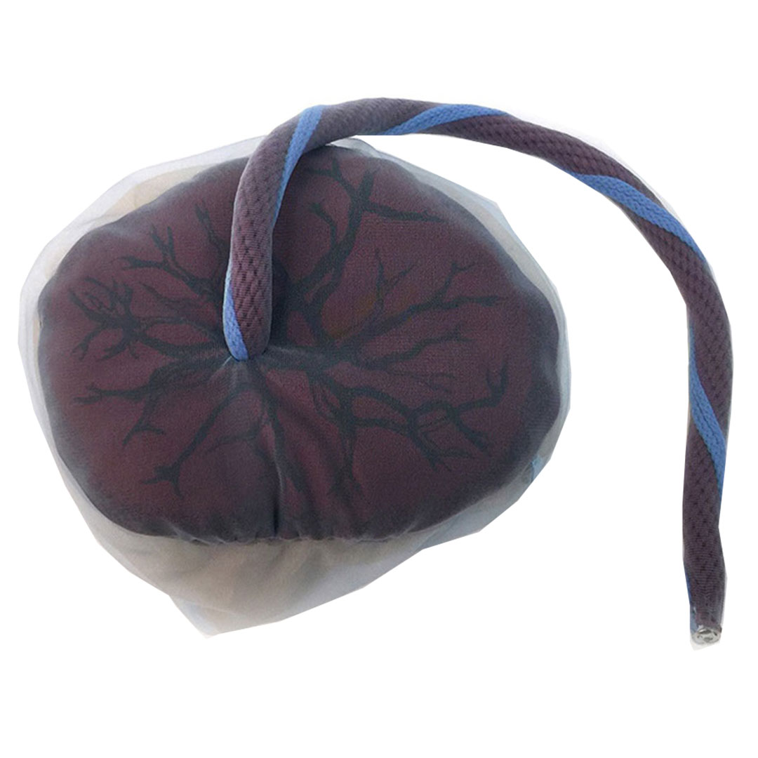 ERLER ZIMMER Plazenta und Nabelschnur