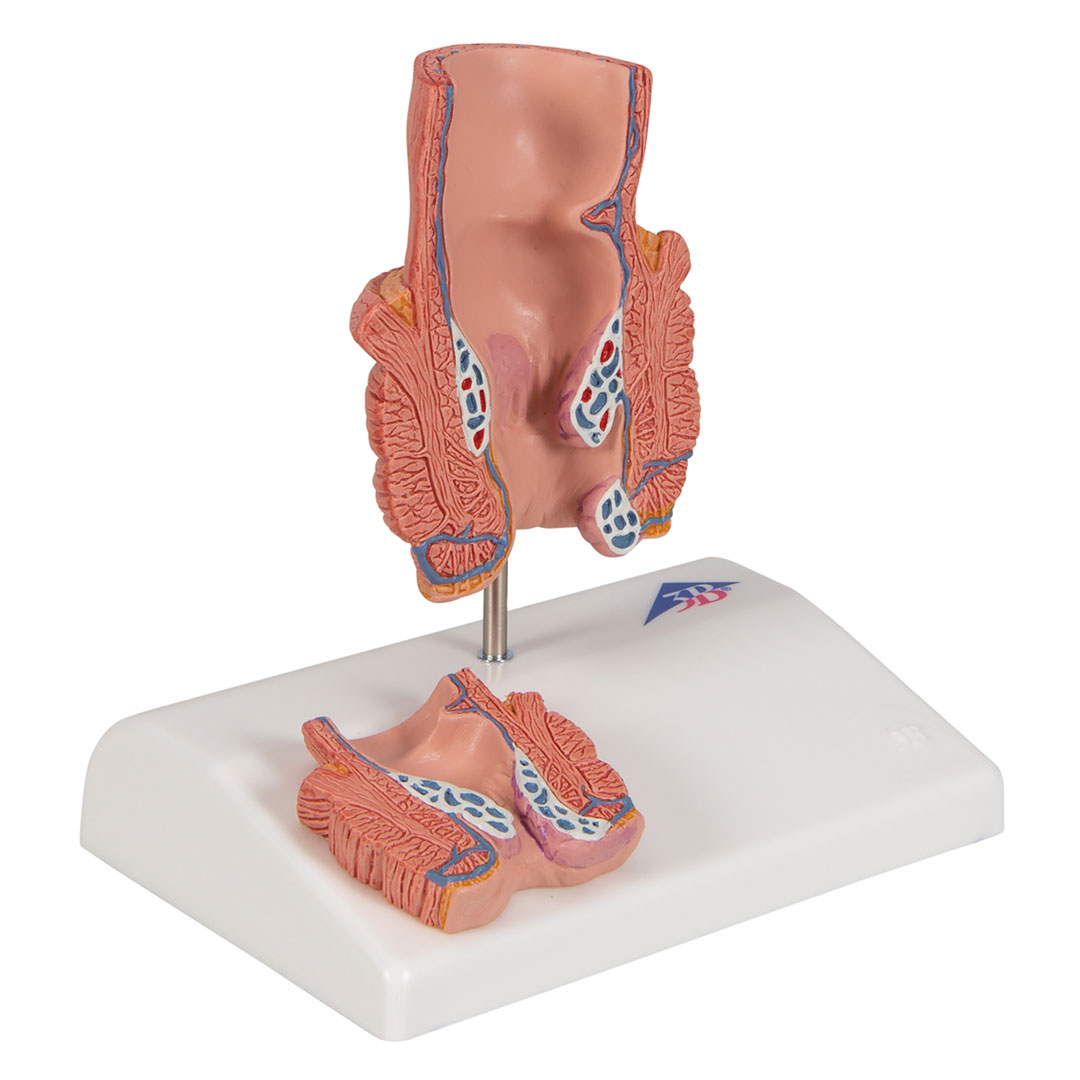 3B SCIENTIFIC Hämorrhoidenmodell (K27)