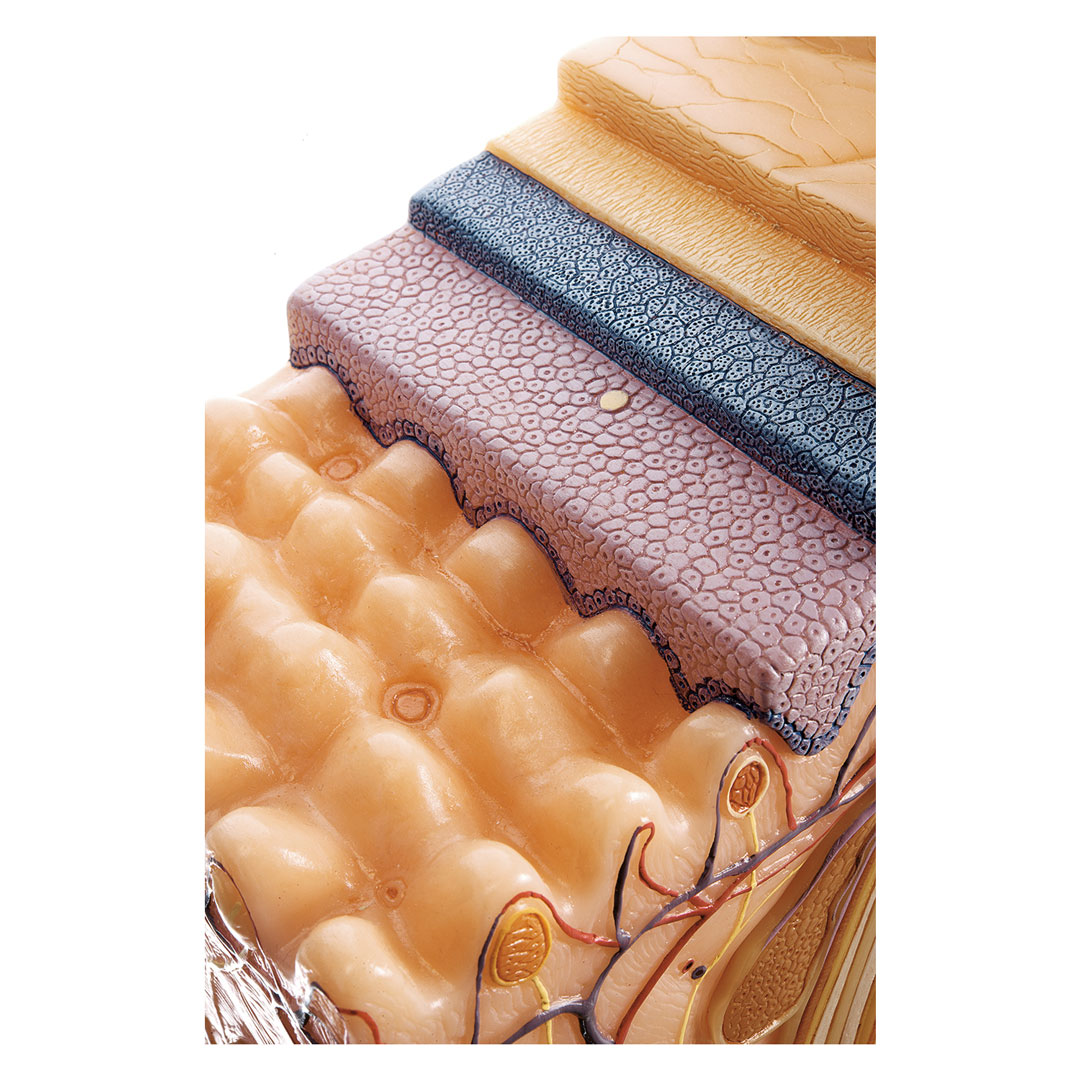 SOMSO® Hautblockmodell, 70fach vergrössert