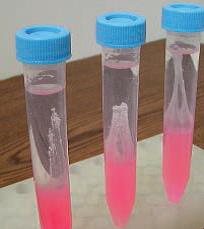 DNA-Gewinnung aus Wangenschleimhautzellen