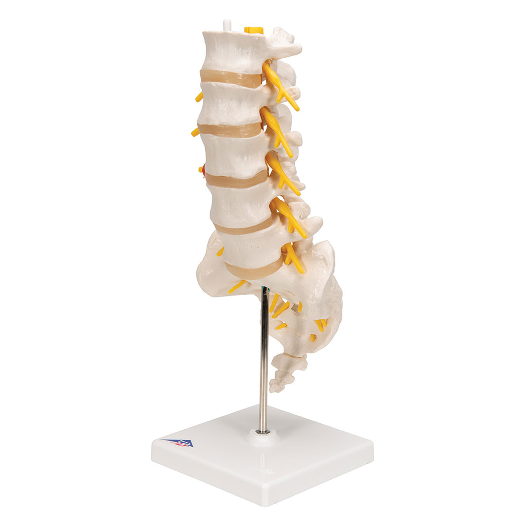 3B SCIENTIFIC Lendenwirbelsäule m. Bandscheibenvorfall (A76/5)