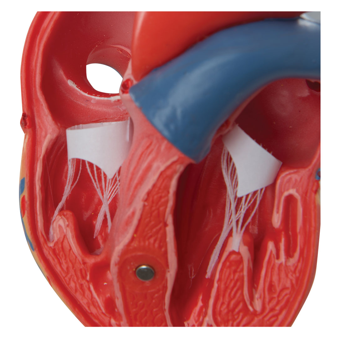 3B SCIENTIFIC Herz, 2-teilig, (G08)